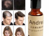 ANDREA Hair Growth Essence Oil Organic Hair Oi